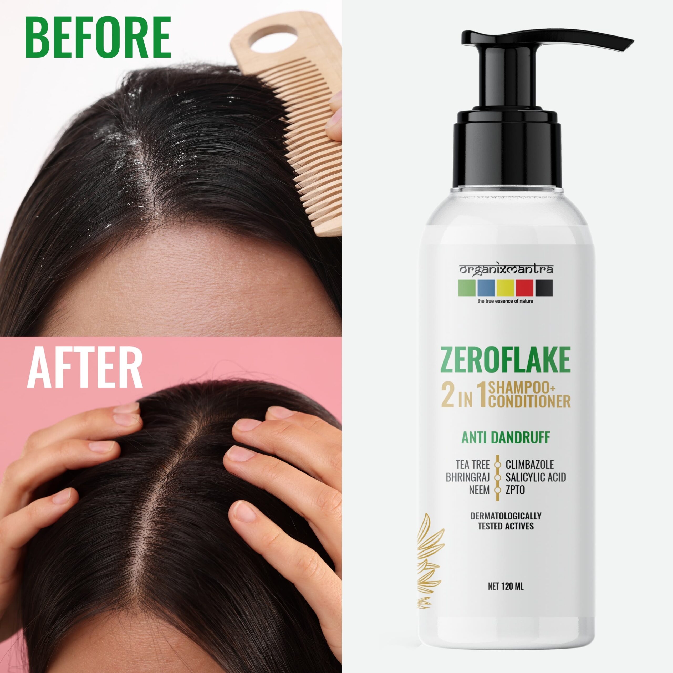 ZeroFlake Anti Dandruff 2-in-1 Shampoo & Conditioner 8 neem shampoo for dandruff