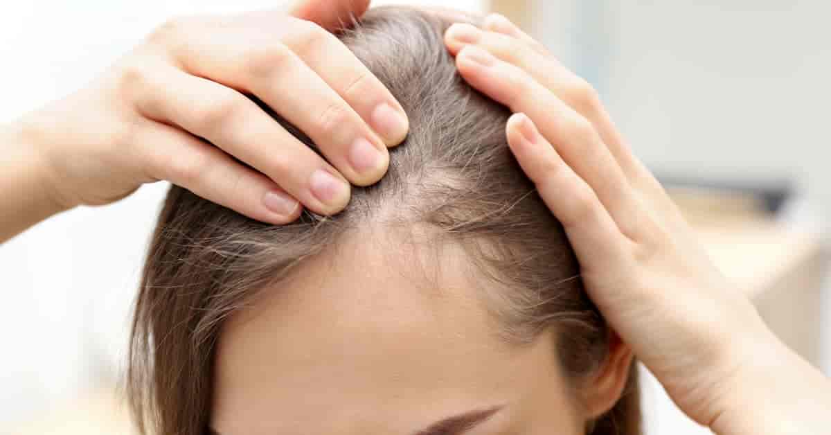 7 tips for hair regrowth 1 1